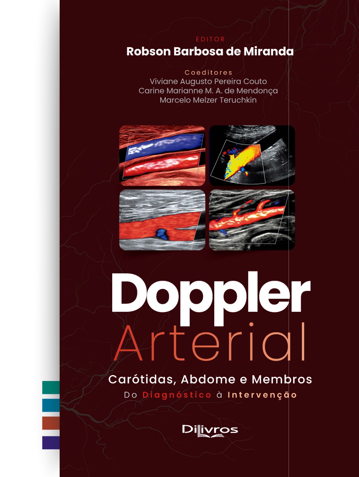 Capa do livro Doppler Arterial - Carótidas, Abdome e Membros